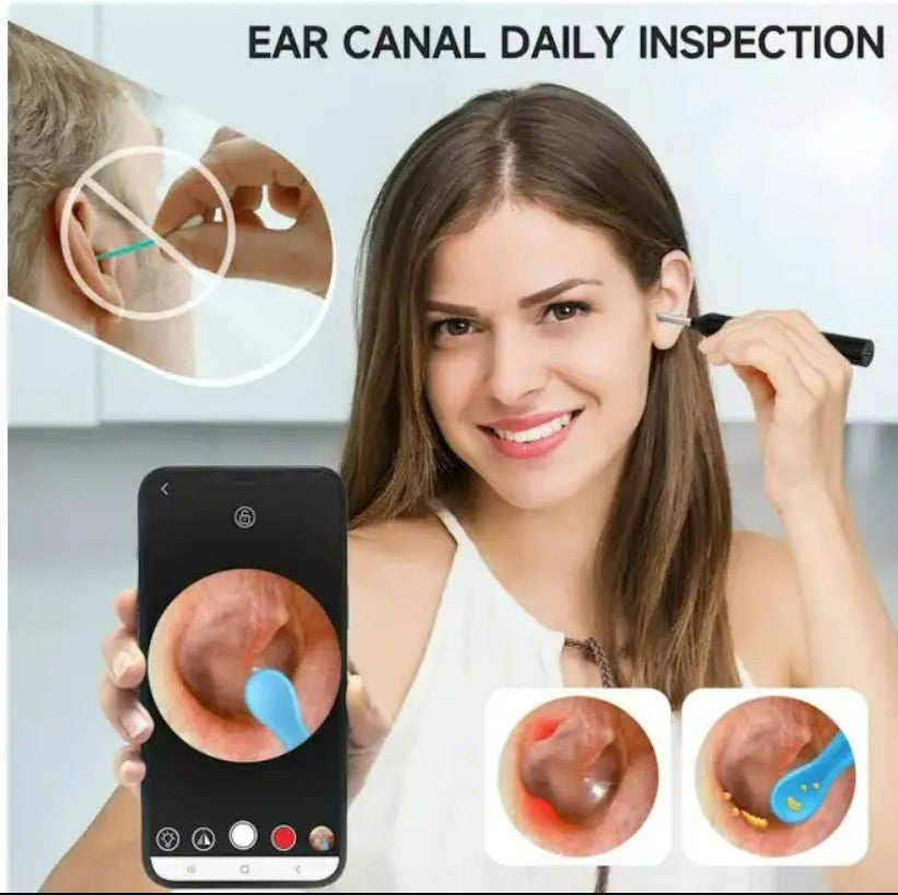 Earwax Remover with Camera_2